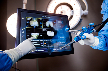 NAVIO Handpiece and Touchscreen